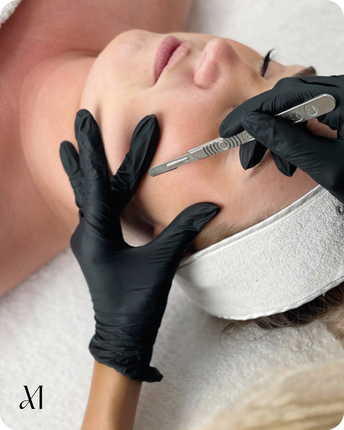 dermaplaning1